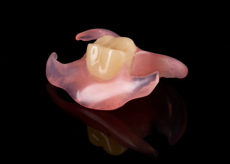 Flexible RPD