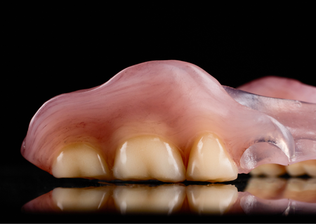 Flexible RPD
