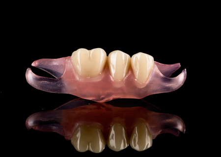 Flexible RPD