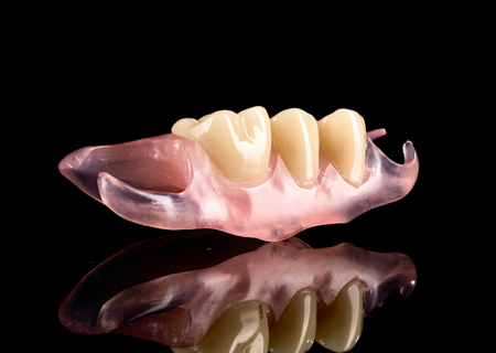 Flexible RPD