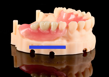 Flexible RPD