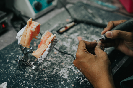 Dental Lab Services