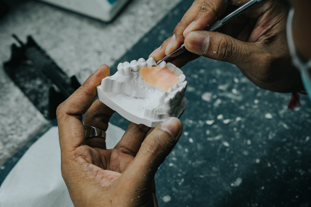 Dental Lab Services