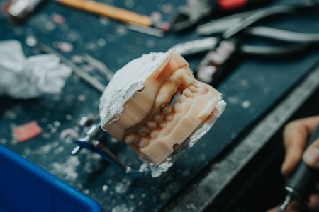 Dental Lab Services