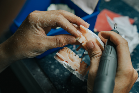 Dental Lab Services