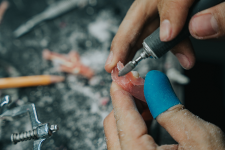 Dental Lab Services