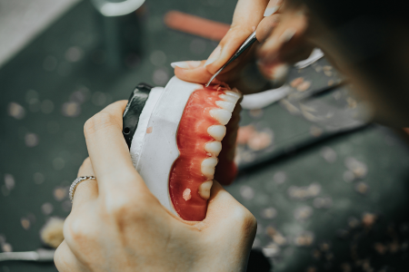 Dental Lab Services