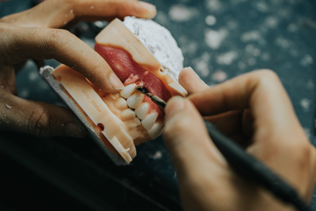 Dental Lab Services