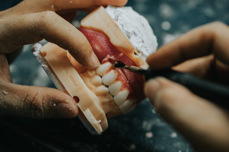 Dental Lab Services