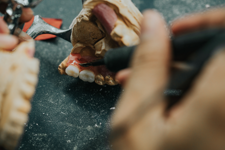 Dental Lab Services