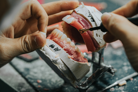 Dental Lab Services