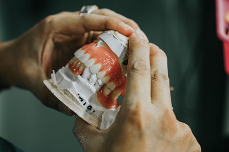 Dental Lab Services