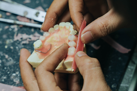 Dental Lab Services