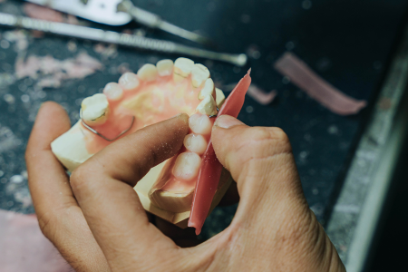 Dental Lab Services