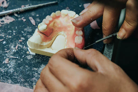 Dental Lab Services
