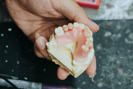 Dental Lab Services