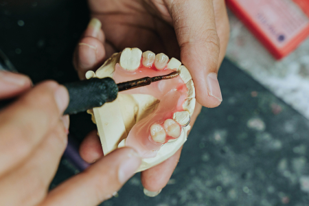 Dental Lab Services