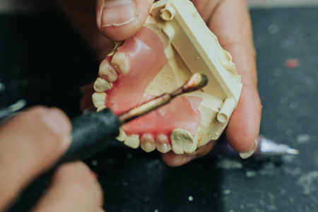 Dental Lab Services