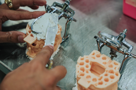 Dental Lab Services