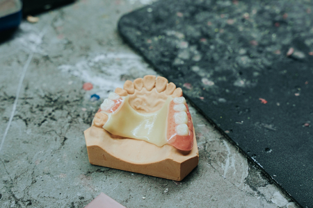 Dental Lab Services