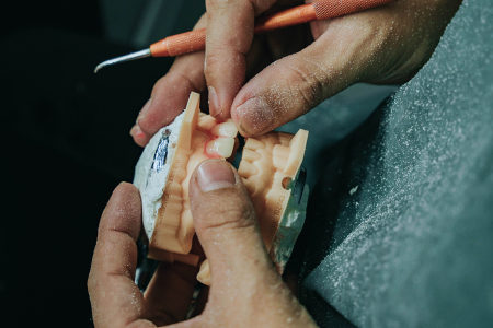 Dental Lab Services