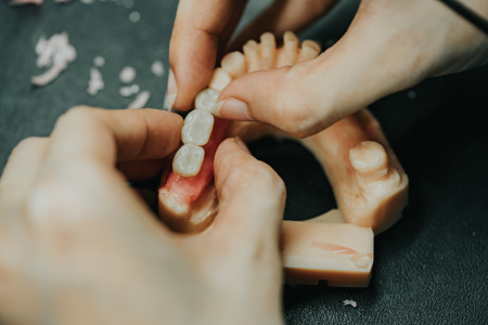 Dental Lab Services