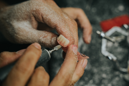 Dental Lab Services