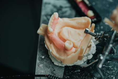 Dental Lab Services