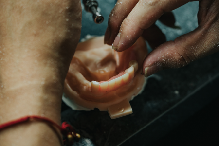Dental Lab Services