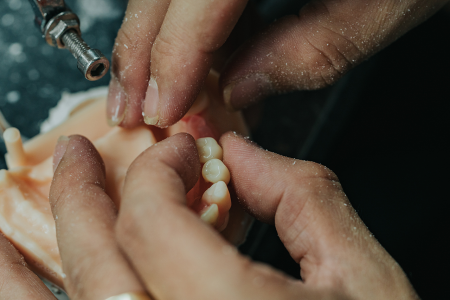 Dental Lab Services
