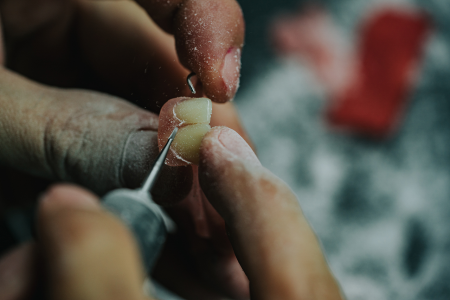 Dental Lab Services