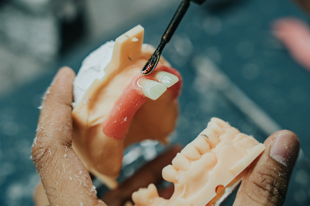 Dental Lab Services