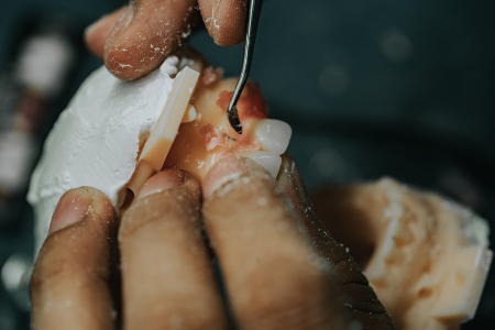 Dental Lab Services