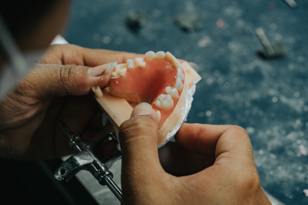 Dental Lab Services