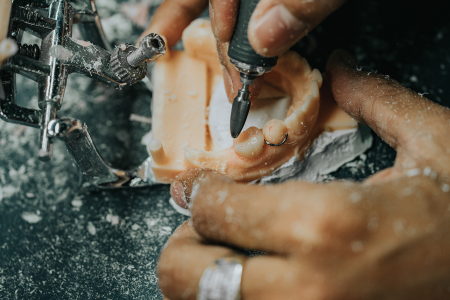 Dental Lab Services