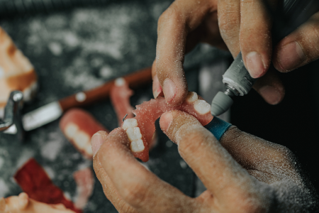 Dental Lab Services