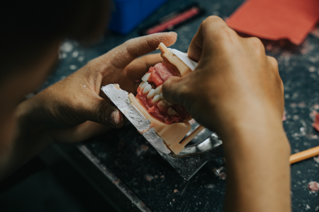 Dental Lab Services