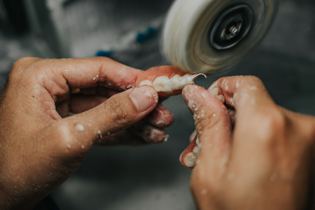 Dental Lab Services