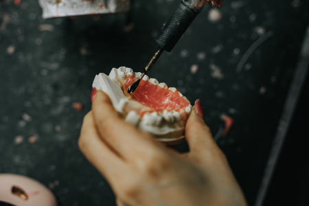 Dental Lab Services