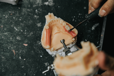Dental Lab Services