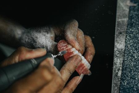 Dental Lab Services