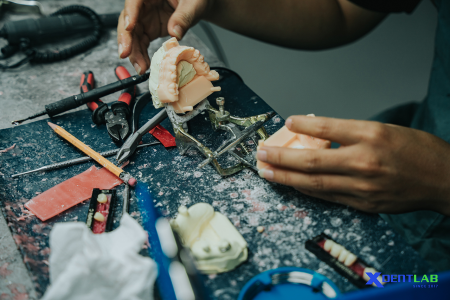 Dental Lab Services
