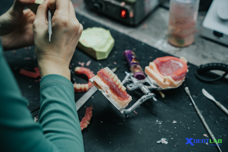 Dental Lab Services