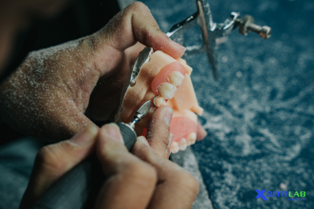 Dental Lab Services