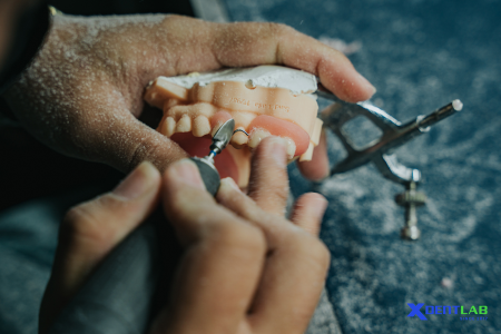 Dental Lab Services