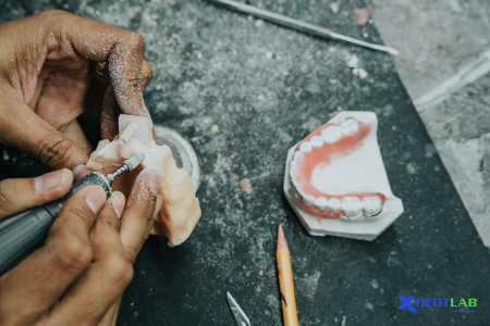 Dental Lab Services