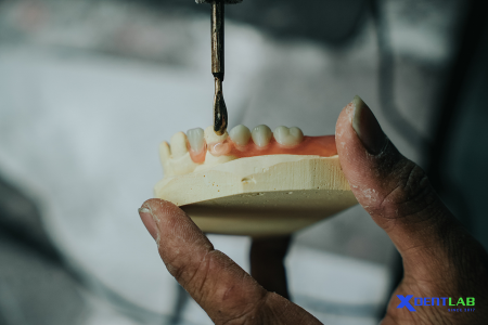 Dental Lab Services