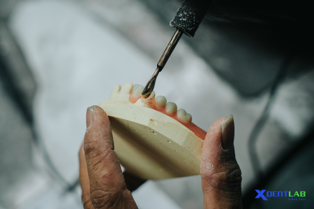 Dental Lab Services