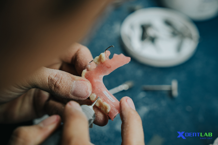 Dental Lab Services