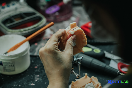 Dental Lab Services